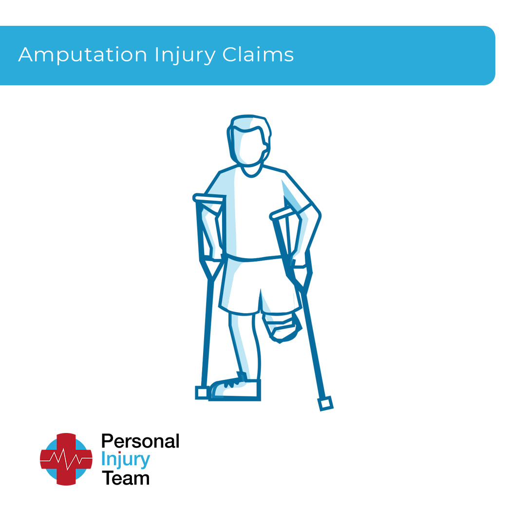 Amputation Injury Claims